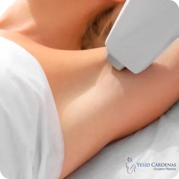 Depilación lasér medellin