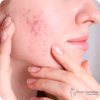 Nanopore Medellín Colombia 