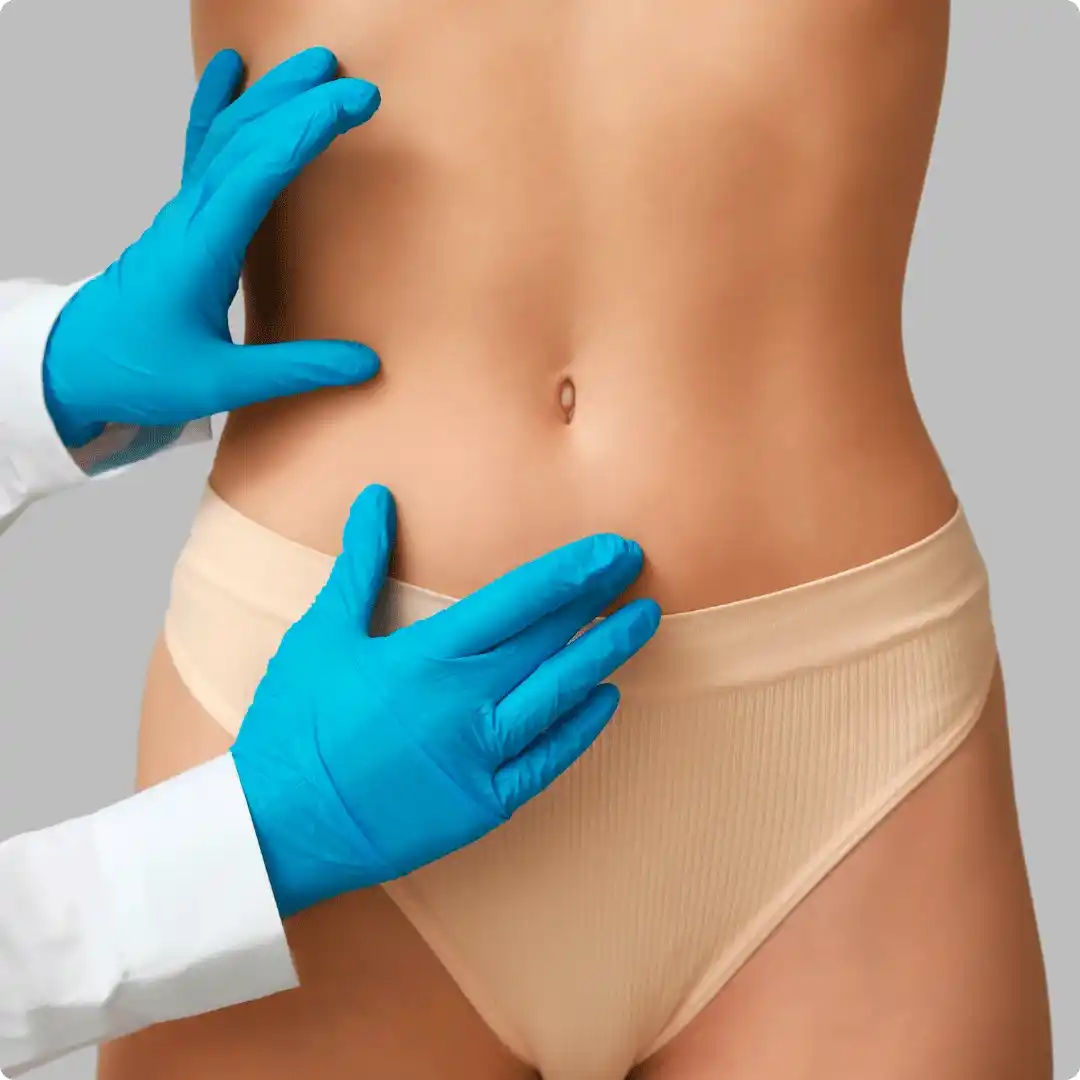  Abdominoplastia 