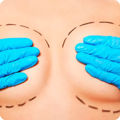 aumento de senos medellin