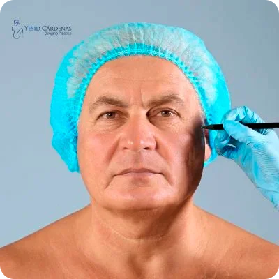  Blefaroplastia Medellin 