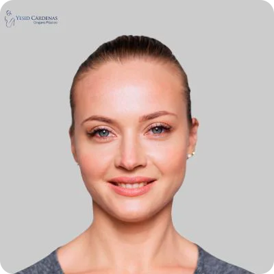 Frontoplastia medellín 