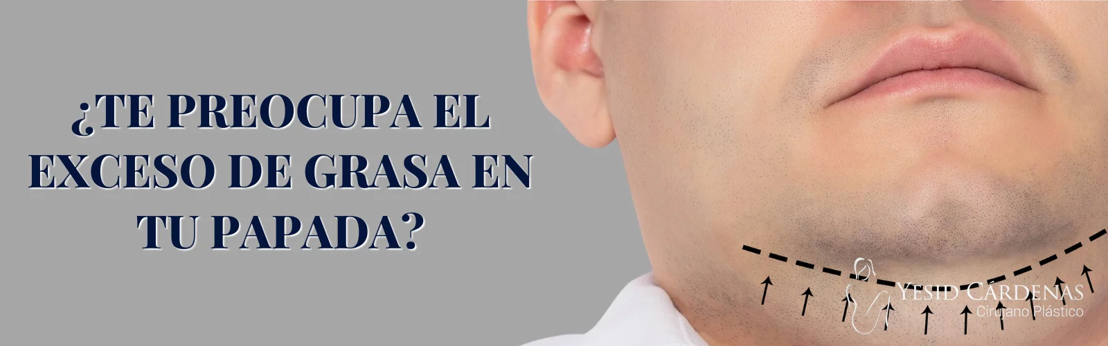 Cervicoplastia Medellín Colombia