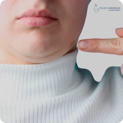 cervicoplastia medellin colombia